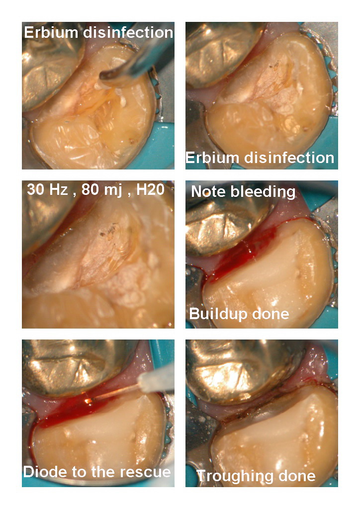 Crown prep BS pg 2.jpg